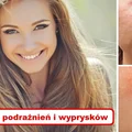 Jeżeli chcesz się cieszyć piękną skórą BEZ PODRAŻNIEŃ I WYPRYSKÓW – pamiętaj o tym!