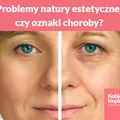 Problemy natury estetycznej, czy oznaki choroby?