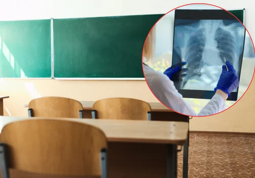 Potwierdzony przypadek gruźlicy w polskiej szkole! Setki dzieci i dorosłych zagrożonych - Sanepid rozpoczął procedury