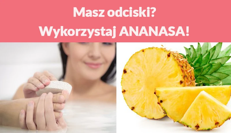 Masz odciski? Wykorzystaj ANANASA!