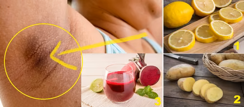 Jak rozjaśnić CIEMNĄ SKÓRĘ pod pachami?