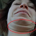 Dzięki temu w prosty sposób pozbędziesz się PODWÓJNEGO PODBRÓDKA!