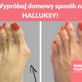 Wypróbuj domowy sposób na HALLUKSY!