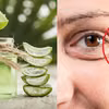 Jak walczyć ze zmarszczkami za pomocą aloesu? 3 skuteczne sposoby