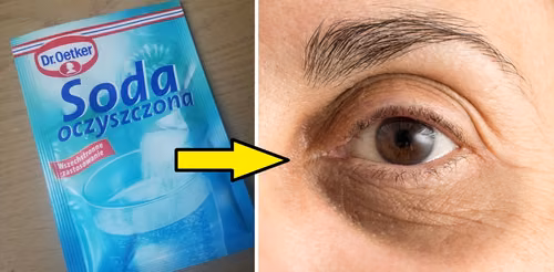 Soda oczyszczona – złoty środek na cienie i „worki” pod oczami!