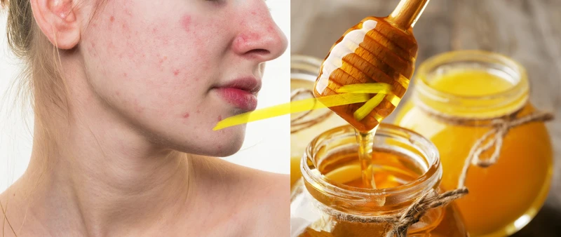 14 sposobów na wykorzystanie miodu – niewiele ludzi o tym wie