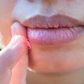 7 naturalnych sposobów na ukojenie spierzchniętych ust! Nałóż i idź spać, a rano będzie w szoku!