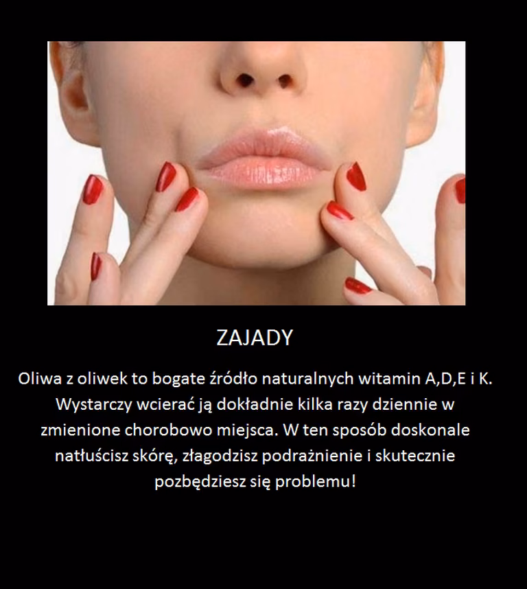 Domowy sposób na zajady