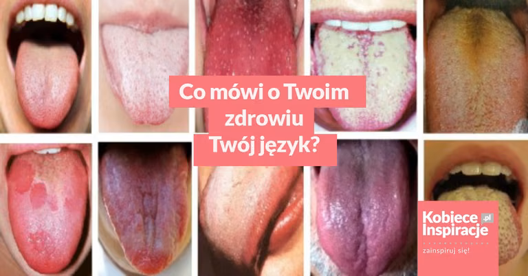 Co mówi o Twoim zdrowiu Twój język?