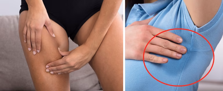 Lato może przysparzać nam wiele problemów urodowych. Jak ich uniknąć?