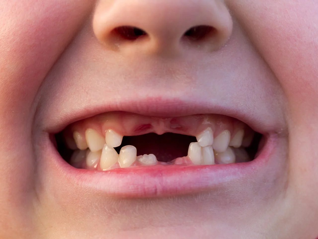 Czy warto przechowywać mleczne zęby?  To może uratować życie!