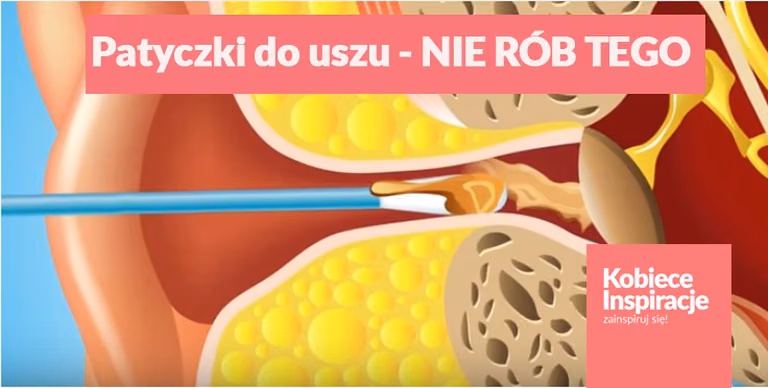 Czyścisz uszy patyczkiem? Sprawdź, dlaczego powinnaś przestać