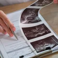 Utrata zasiłku chorobowego i nowe zasady kontroli L4! Idzie rewolucja w zwolnieniach lekarskich