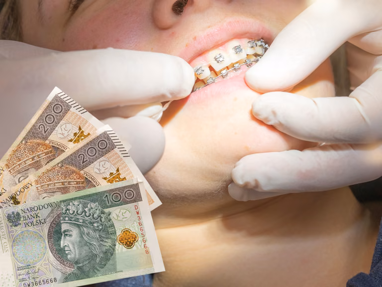 500 plus na dentystę dla każdego! Dofinansowanie, o którym niewiele osób wie!