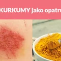Użyj KURKUMY jako opatrunek!