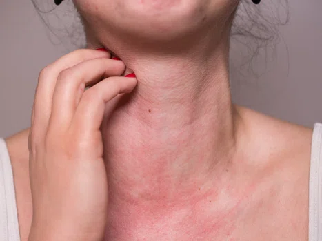 Poznaj mity dotyczące alergii!
