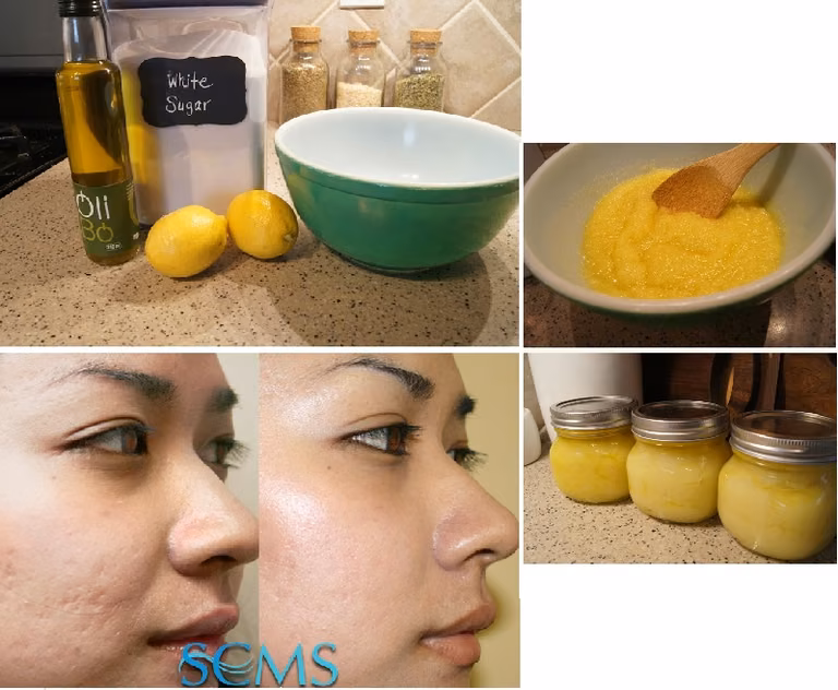Domowy peeling