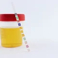 Domowy test z apteki na badanie moczu: Co wykryje? Kto powinien zrobić?