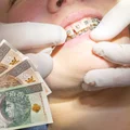 500 plus na dentystę dla każdego! Dofinansowanie, o którym niewiele osób wie!