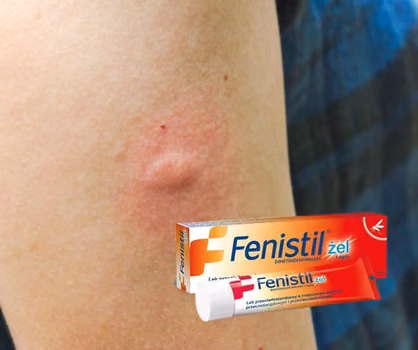 10 zastosowań Fenistil żelu. Działa bardzo szybko i przynosi znaczną ulgę.