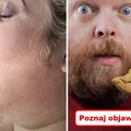 Poznaj objawy zbyt wysokiego poziomu CUKRU!