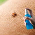 Naukowcy potwierdzają: Ten domowy spray to broń przeciwko kleszczom, której potrzebujesz!