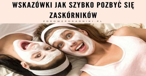 Wskazówki jak szybko pozbyć się zaskórników
