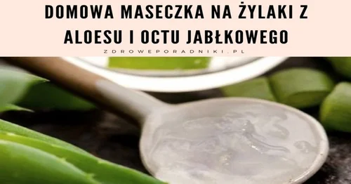 Domowa maseczka na żylaki z aloesu i octu jabłkowego