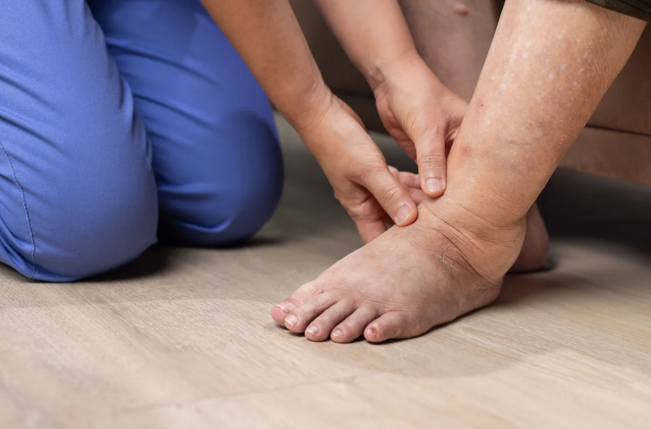 To nie sól zatrzymuje najwięcej wody w organizmie! Ten składnik jest znacznie gorszy