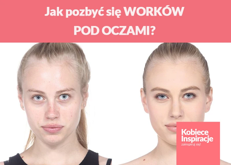 Jak pozbyć się WORKÓW POD OCZAMI?