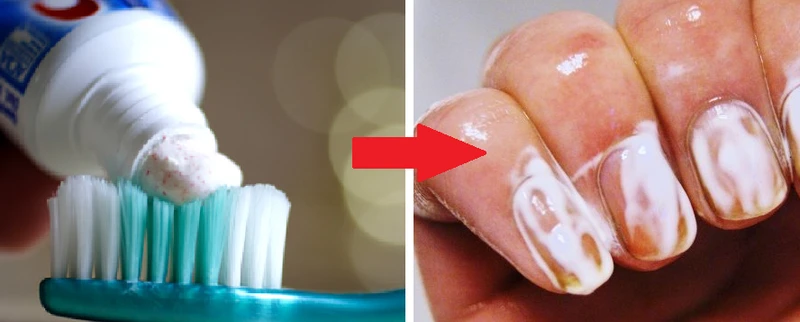 Wykorzystaj pastę do zębów i zadbaj o swoje PAZNOKCIE
