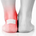 JAK ROZCIĄGNĄĆ CIASNE BUTY?