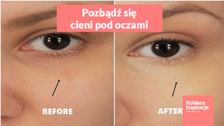 Jeden składnik, dzięki któremu pozbędziesz się cieni pod oczami