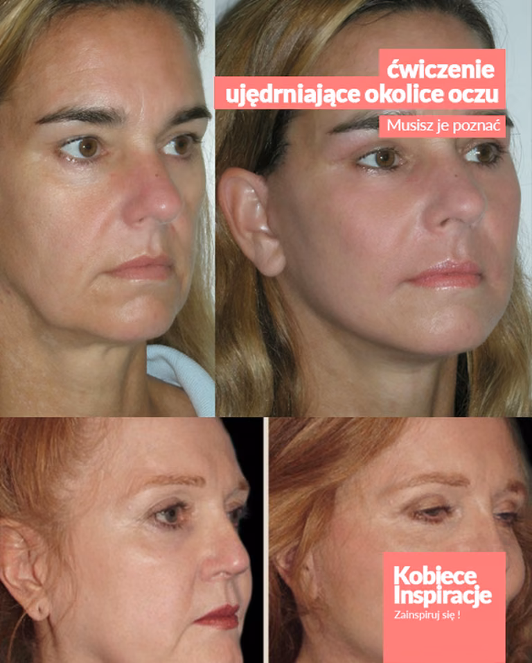 Face Fitness – ćwiczenie ujędrniające okolice oczu. [video]