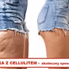 Walczysz z CELLULITEM? Ta mikstura Ci w tym pomoże!