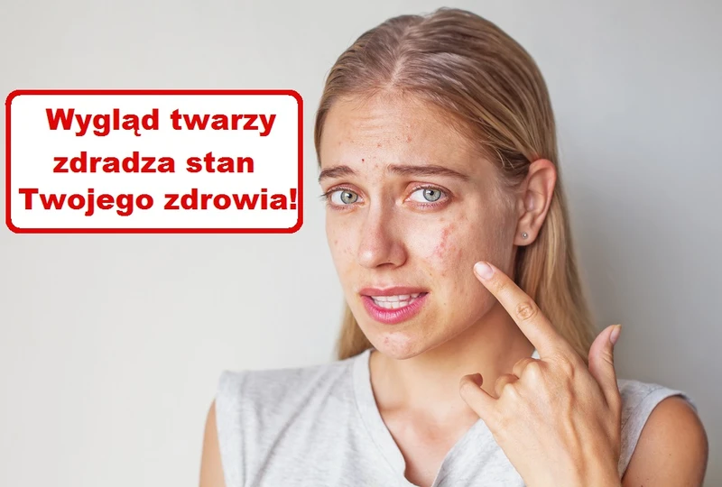 Co Twoja TWARZ zdradza o Twoim zdrowiu?