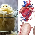 3 fermentowane produkty, które powinnaś jeść, by być zdrowa