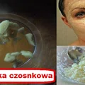 Wypróbuj CZOSNKOWĄ maseczkę która odmłodzi Twoją TWARZ i SZYJĘ!