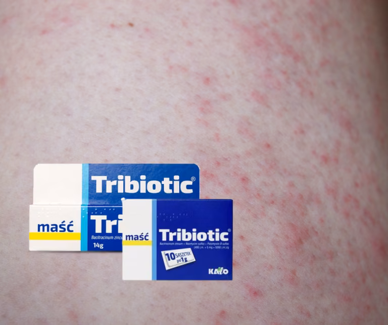 TRIBIOTIC - maść za około 2 złote, która potrafi zdziałać cuda!