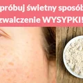 Wypróbuj świetny sposób na zwalczenie WYSYPKI!