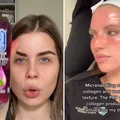 Niebezpieczne trendy z TikToka! Tych urodowych porad nie stosuj