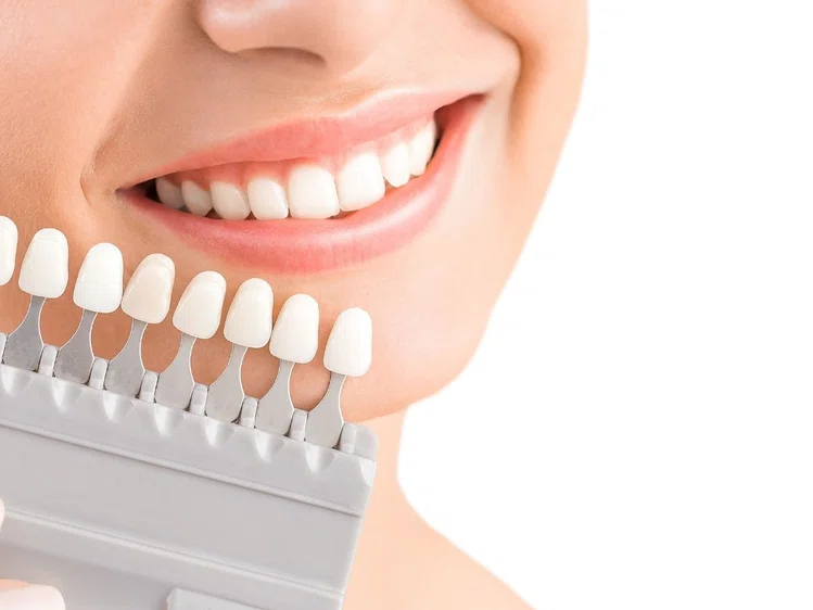 Zdjęcie Co najbardziej barwi zęby? Poznaj 8 produktów! #1