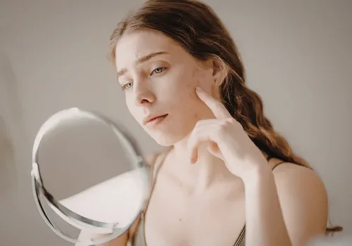 Skóra w kwietniu wariuje - to alergia, hormony czy pielęgnacja?