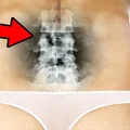 3 ćwiczenia na doskonałą postawę ciała