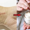 Domowe sposoby, aby pozbyć się niechcianych blizn!