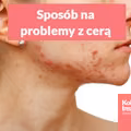 Przewlekły lęk i stres, a problemy z cerą