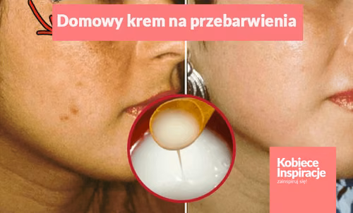 Domowy krem rozjaśniający przebarwienia – bez chemii i konserwantów