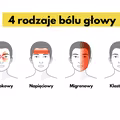 4 rodzaje bólu głowy. Jak je odróżnić?