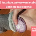3 lecznicze zastosowania cebuli. Będziesz zaskoczona!