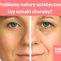 Problemy natury estetycznej, czy oznaki choroby?